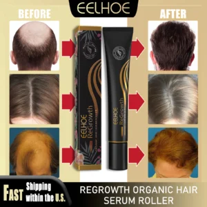 EELHOE Hair Regrowth Serum